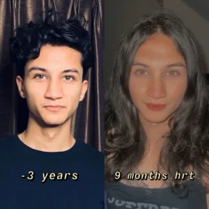 Anaya Bangar Before and After